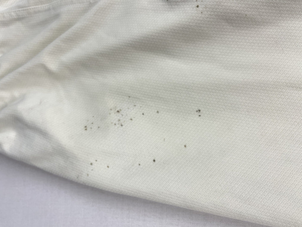 Marks on the leg
