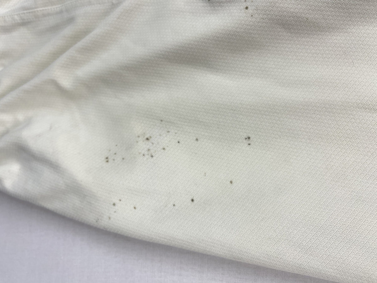 Marks on the leg